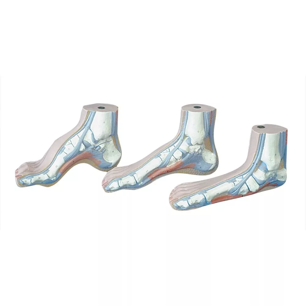 Alimed Anatomical Models of the Foot Arched Foot (Cavus) Model - 7578
