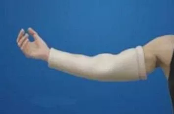 Alimed Double Elbow / Arm Tube DermaSaver™ X-Small - Each - 2970002593-EA