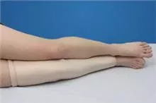 Alimed Leg Tube DermaSaver™ Small - Each - 2970006289-EA