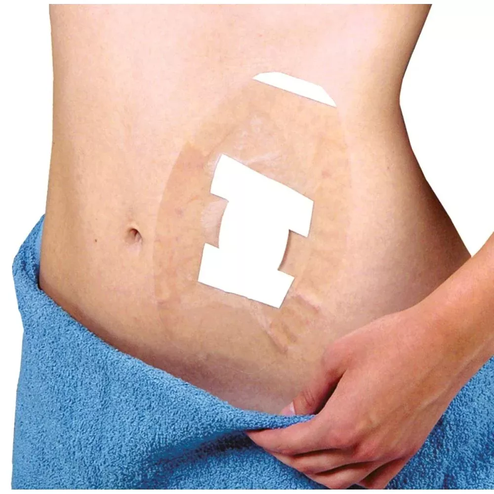 BrownMed SEAL-TIGHT Shield Seal-Tight Shield - 66173