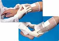 EA/1 - Surgilast Tubular Elastic Dressing Retainer, Size 2, 8" x 25 yds. (Small: Hand, Arm, Leg and Foot)Manufacturer #: 702