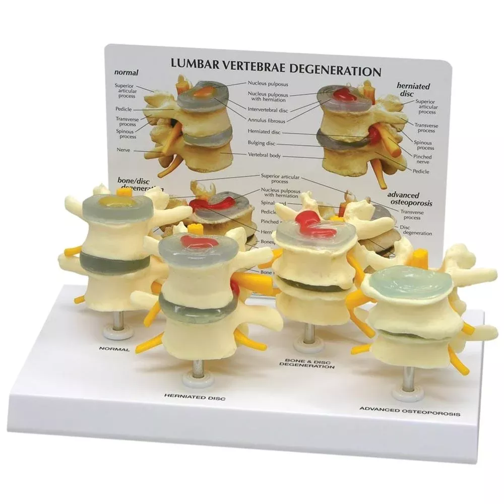 GPI Anatomicals 4 Stage Vertebrae Model 4 Stage Vertebrae Model - 70577