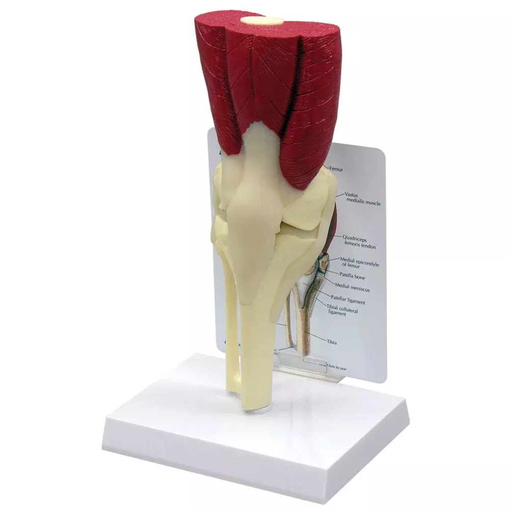 GPI Anatomicals Muscled Knee Model Muscled Knee Model - 70816