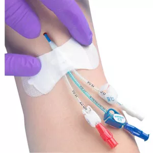 Tidi 3300MWA - Grip-Lok Securement Device for Universal PICC Catheter, 3-1/2", 1/4" - 1/2" Tubing